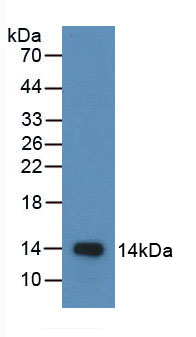 巨噬细胞炎性蛋白1β(MIP1b)活性蛋白