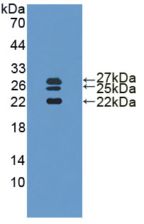 白介素1受体拮抗剂(IL1RA)活性蛋白