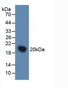 白介素1受体拮抗剂(IL1RA)活性蛋白