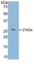 白介素2受体β(IL2Rb)活性蛋白