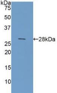 半乳糖凝集素3(GAL3)活性蛋白