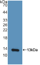 10kDa干扰素γ诱导蛋白(IP10)活性蛋白