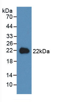 高遷移率族蛋白1(HMGB1)活性蛋白