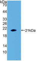白介素1β(IL1b)活性蛋白