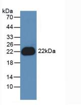 白介素1β(IL1b)活性蛋白