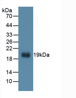 白介素1β(IL1b)活性蛋白