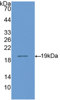 CD14分子(CD14)活性蛋白