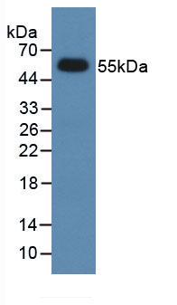 Dickkopf相关蛋白1(DKK1)活性蛋白