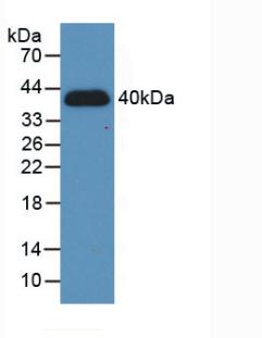 低氧诱导因子1α(HIF1a)活性蛋白
