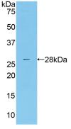 甘露聚糖结合凝集素关联丝氨酸蛋白酶2(MASP2)活性蛋白