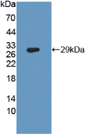 CD26分子(CD26)活性蛋白