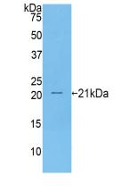 肿瘤坏死因子受体超家族成员7(TNFRSF7)活性蛋白