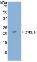 白介素25(IL25)活性蛋白