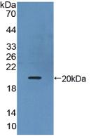 白介素17B(IL17B)活性蛋白