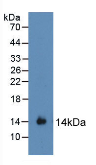 信号传导转录激活因子3(STAT3)活性蛋白
