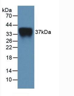白介素2受体α(IL2Ra)活性蛋白