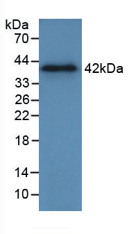 膜联蛋白A2(ANXA2)活性蛋白