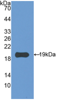 膜聯(lián)蛋白A2(ANXA2)活性蛋白