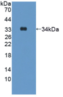鐵調素(Hepc)活性蛋白