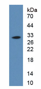 白介素34(IL34)活性蛋白