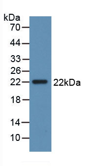 白介素28B(IL28B)活性蛋白