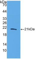 白介素20(IL20)活性蛋白