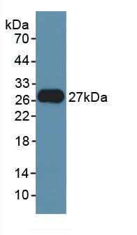 成纤维细胞生长因子21(FGF21)活性蛋白