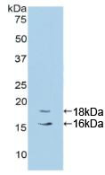 細胞色素P450家族成員1B1(CYP1B1)活性蛋白
