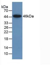 Lemur酪氨酸激酶3(LMTK3)活性蛋白