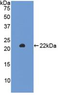 沉默調(diào)節(jié)蛋白3(SIRT3)活性蛋白