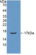 再生胰岛衍生蛋白3β(REG3b)活性蛋白