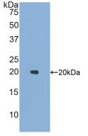 白介素1家族成员9(IL1F9)活性蛋白