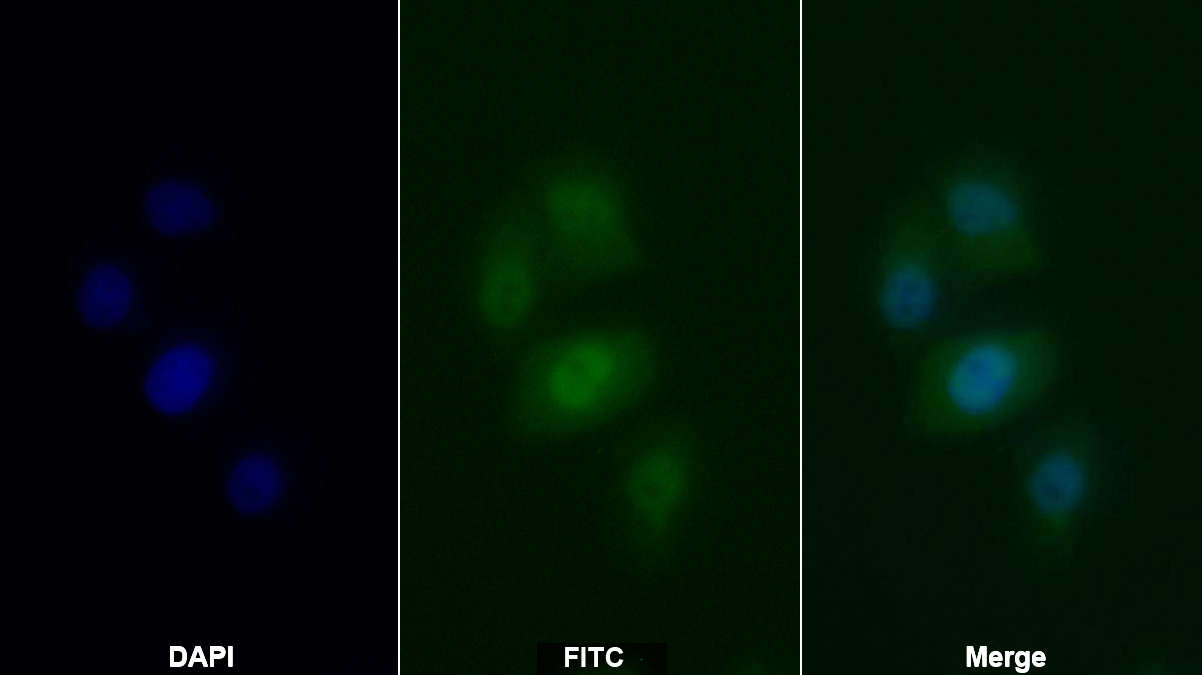 抗抗增殖细胞核抗原(PCNA)单克隆抗体