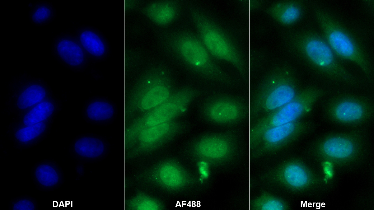 抗亲环素A(CYPA)单克隆抗体