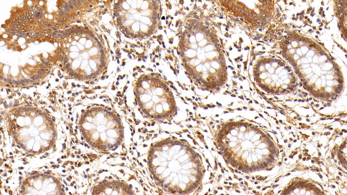 抗连环蛋白β1(β-catenin)多克隆抗体
