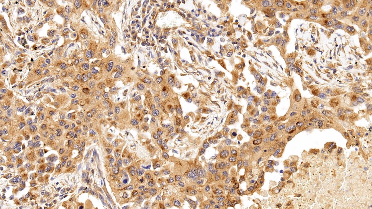 抗连环蛋白β1(β-catenin)多克隆抗体