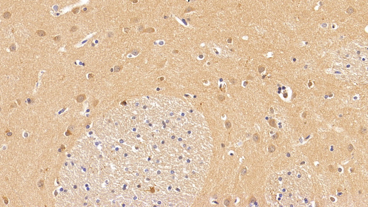 抗连环蛋白β1(β-catenin)多克隆抗体