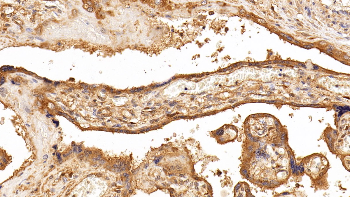 抗连环蛋白β1(β-catenin)多克隆抗体