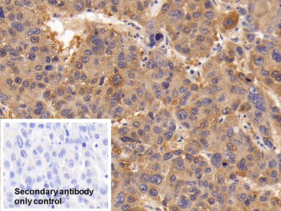 抗连环蛋白β1(β-catenin)多克隆抗体