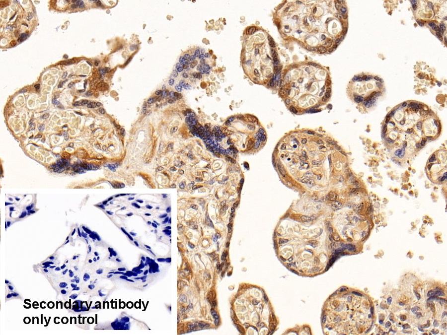 抗连环蛋白β1(β-catenin)多克隆抗体