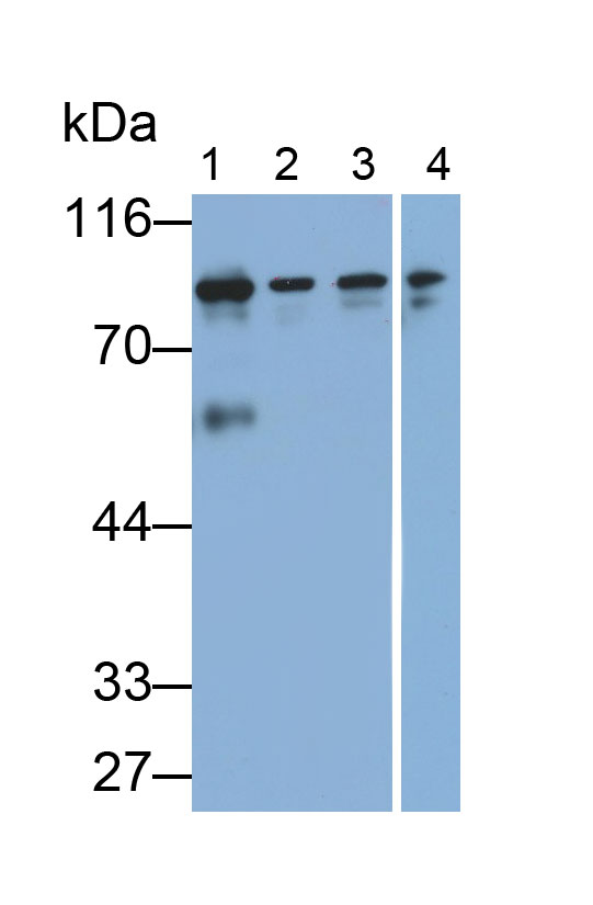 抗连环蛋白β1(β-catenin)多克隆抗体