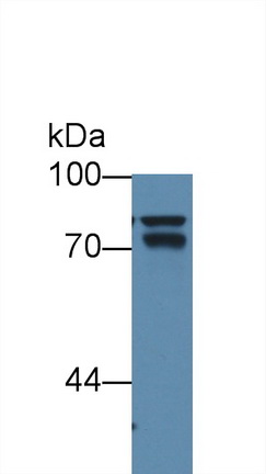抗連環(huán)蛋白β1(β-catenin)單克隆抗體