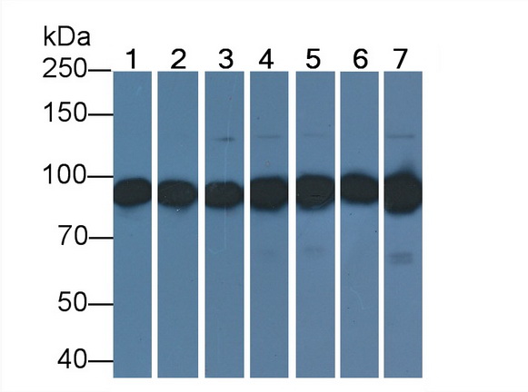 抗連環(huán)蛋白β1(β-catenin)單克隆抗體