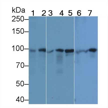抗連環(huán)蛋白β1(β-catenin)單克隆抗體
