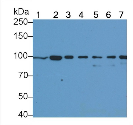 抗连环蛋白β1(β-catenin)单克隆抗体