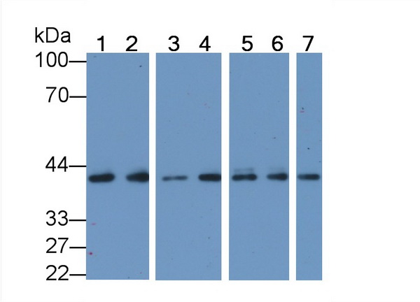 抗心肌肌动蛋白α1(ACTC1)单克隆抗体