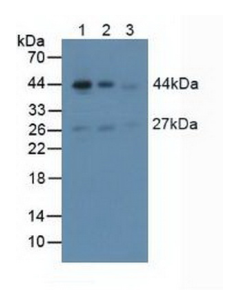 抗平滑肌肌動(dòng)蛋白α2(ACTa2)多克隆抗體