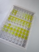 游離三碘甲狀腺原氨酸(fT3)檢測試劑盒(酶聯(lián)免疫吸附試驗法)
