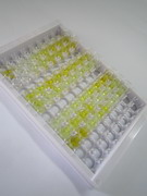卵泡抑素(FS)检测试剂盒(酶联免疫吸附试验法)