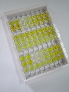 甲状腺素(T4)检测试剂盒(酶联免疫吸附试验法)